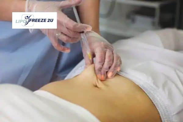 Fat Dissolving Injections Croydon & Weight loss medication