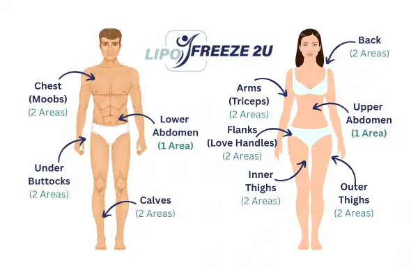 Areas you can have fat freezing treatment Croydon