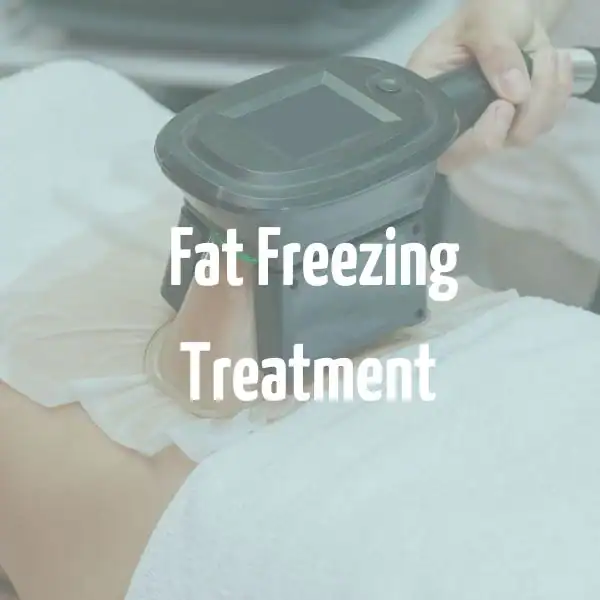 fat freezing treatment Croydon