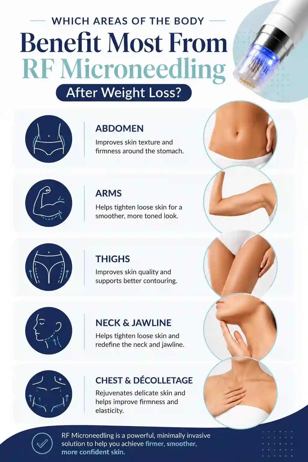Which Areas of the Body Benefit Most From RF Microneedling After Weight Loss Croydon